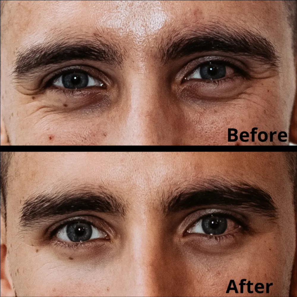 Dark Circle Eliminatore for Men
