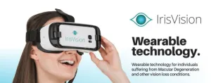 IrisVision